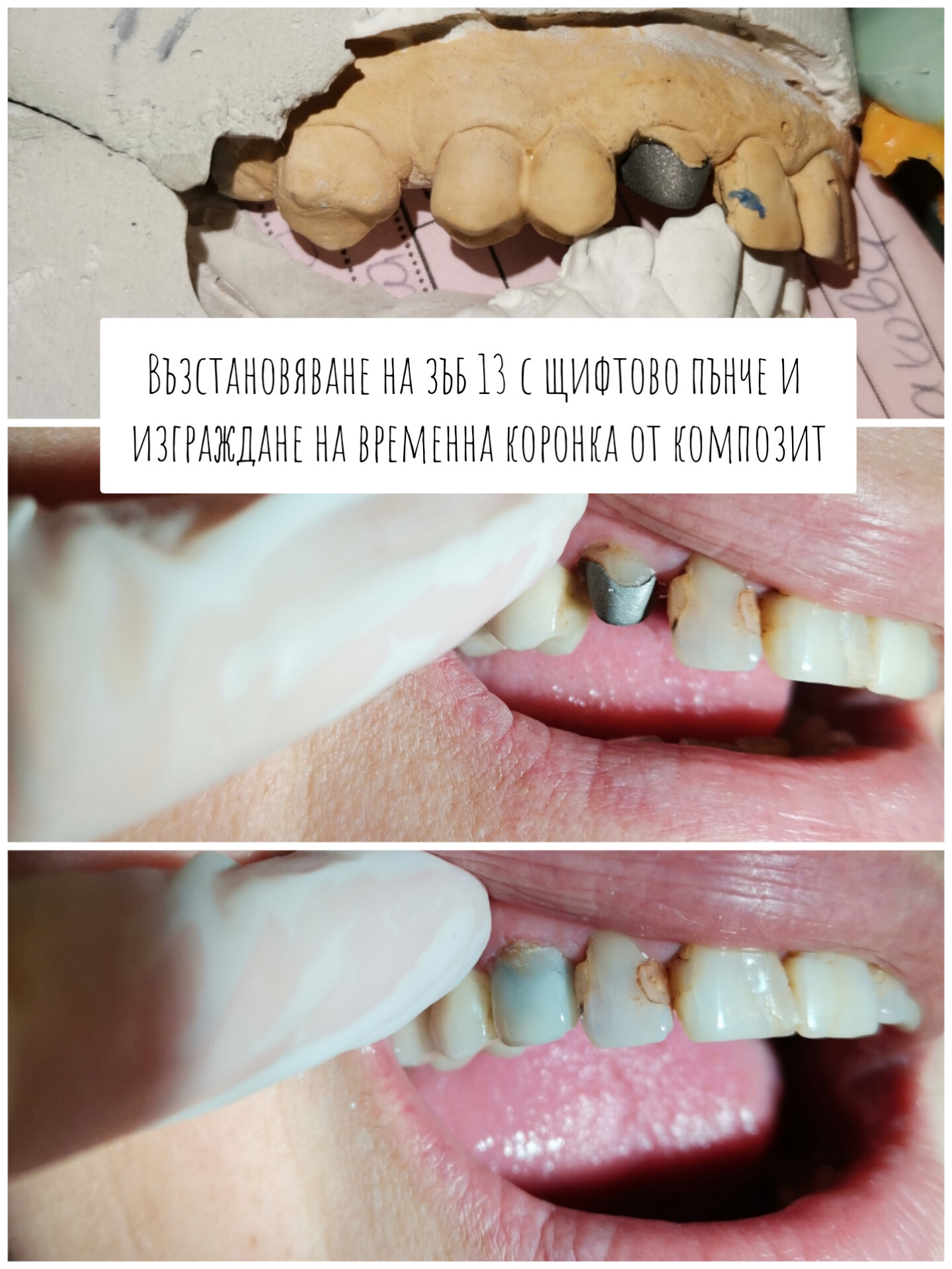 Стоматологични услуги на ниски цени  1